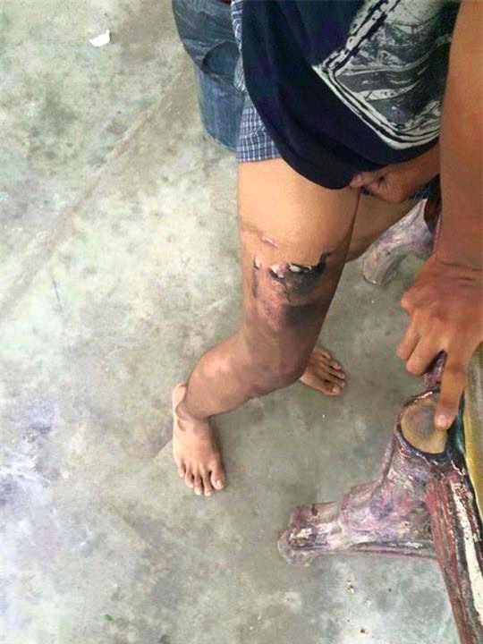 Chủ nhân bị bỏng cả chân Chủ nhân bị bỏng cả chân