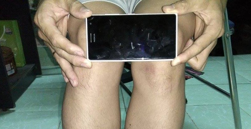 Đầu gối củ lạc của mình đấy Đầu gối củ lạc của mình đấy