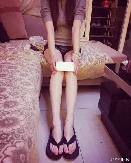 Đầu gối củ lạc của mình đấy Đầu gối củ lạc của mình đấy