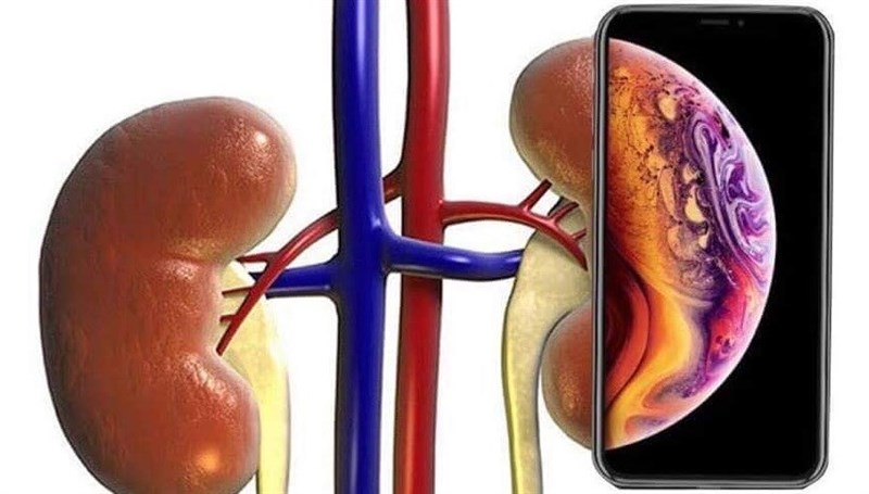 Tổng hợp ảnh vui cộng đồng chế về iPhone 2018 Tổng hợp ảnh vui cộng đồng chế về iPhone 2018