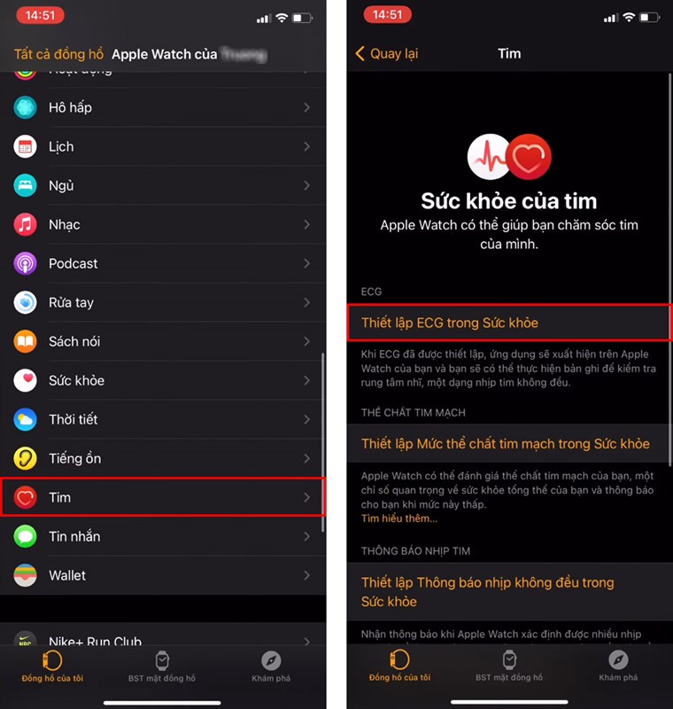 Cach-do-dien-tam-do-ECG-tren-Apple-Watch Cach-do-dien-tam-do-ECG-tren-Apple-Watch