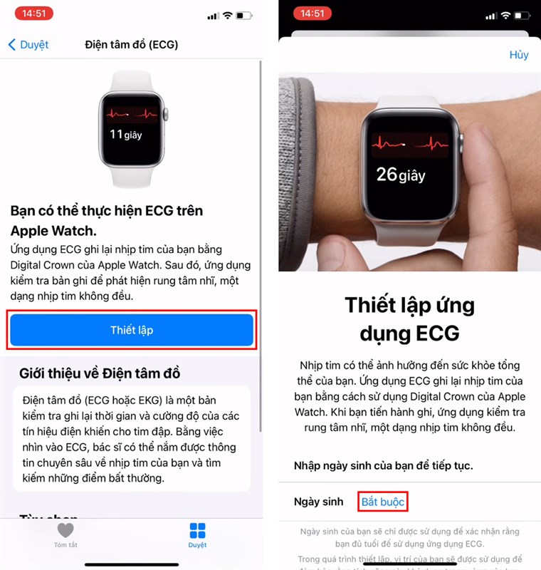 Cach-do-dien-tam-do-ECG-tren-Apple-Watch Cach-do-dien-tam-do-ECG-tren-Apple-Watch