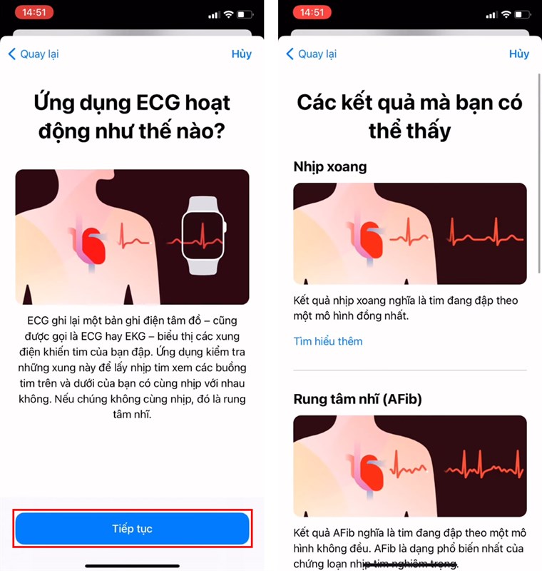 Cach-do-dien-tam-do-ECG-tren-Apple-Watch Cach-do-dien-tam-do-ECG-tren-Apple-Watch