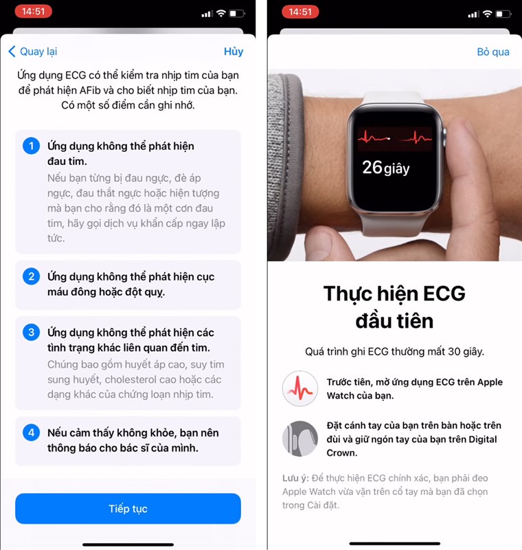 Cach-do-dien-tam-do-ECG-tren-Apple-Watch Cach-do-dien-tam-do-ECG-tren-Apple-Watch