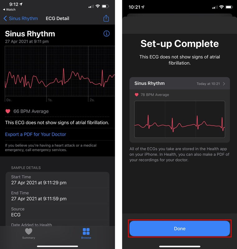 Cach-do-dien-tam-do-ECG-tren-Apple-Watch Cach-do-dien-tam-do-ECG-tren-Apple-Watch
