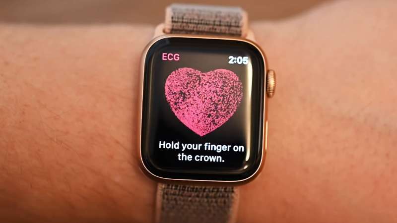 ECG Apple Watch ECG Apple Watch