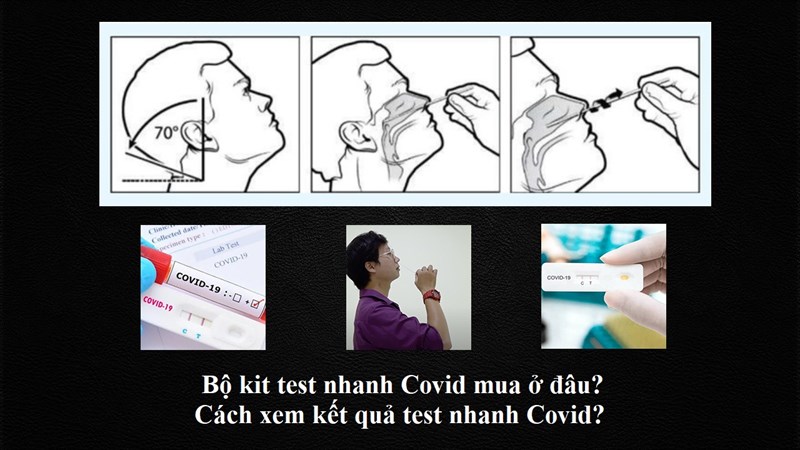 Bộ kit test nhanh Covid mua ở đâu? Cách xem kết quả test nhanh Covid?