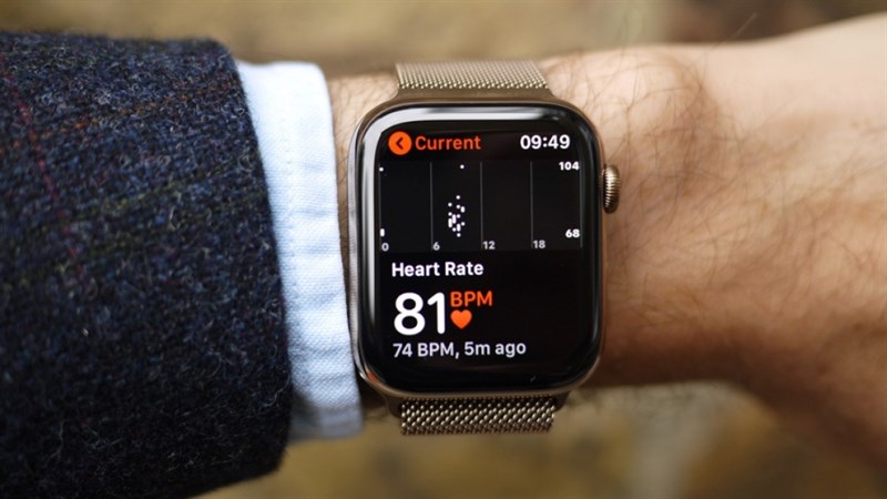 Apple Watch bất ngờ được chứng nhận tính năng đo rung nhĩ trước thềm WWDC 2022