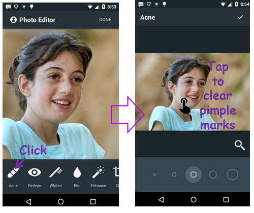 Screenshots Face Acne Remover Photo Editor App: Loại bỏ mụn và làm mịn làn da