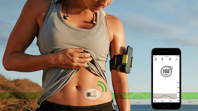 Dexcom G5 Mobile CGM