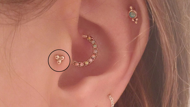 Vị trí Tragus