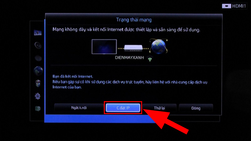Chọn “Cài đặt IP”.